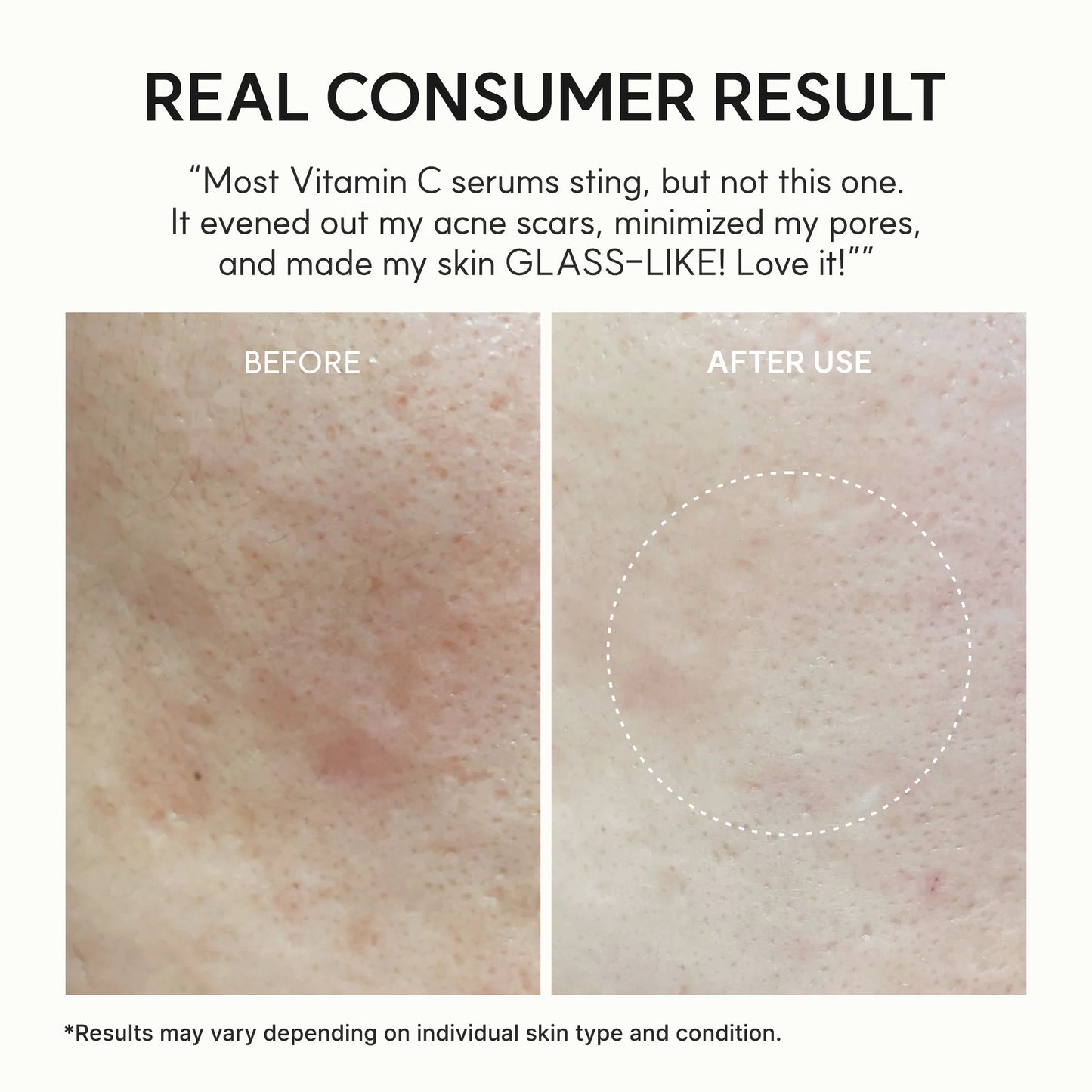 Vitamin C Glow Booster Serum