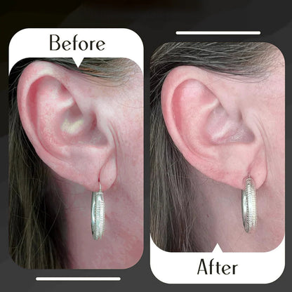 Earlobe Support Patches (100 PCS)