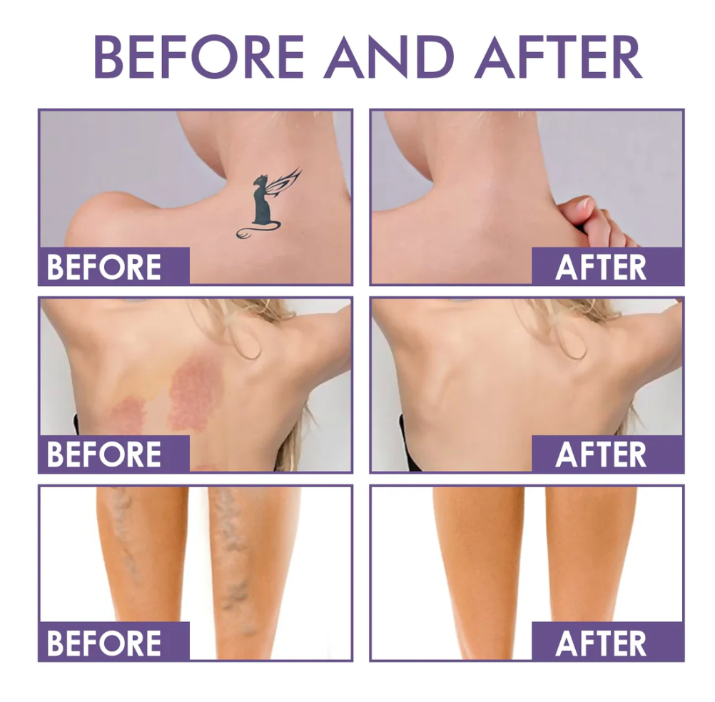 Litflux Body Perfector