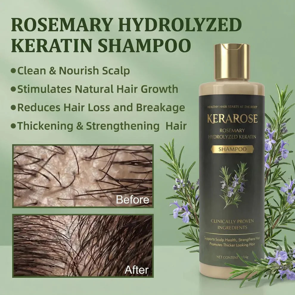 Rosemary Shampoo For Hair Growth (Buy 1 Get 1 Free 🔥🔥)