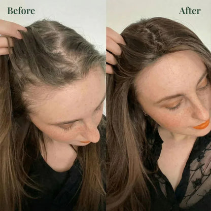 Rosemary Shampoo For Hair Growth (Buy 1 Get 1 Free 🔥🔥)