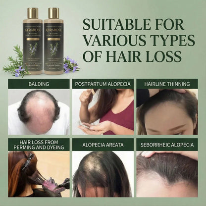 Rosemary Shampoo For Hair Growth (Buy 1 Get 1 Free 🔥🔥)